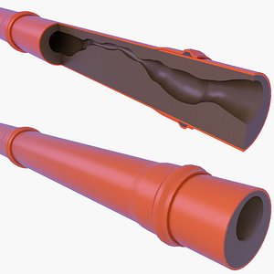 Clogged Drainage Sewage Pipes v10