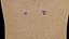 Mole nevus cancer Malignant melanoma differences