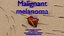 Mole nevus cancer Malignant melanoma differences