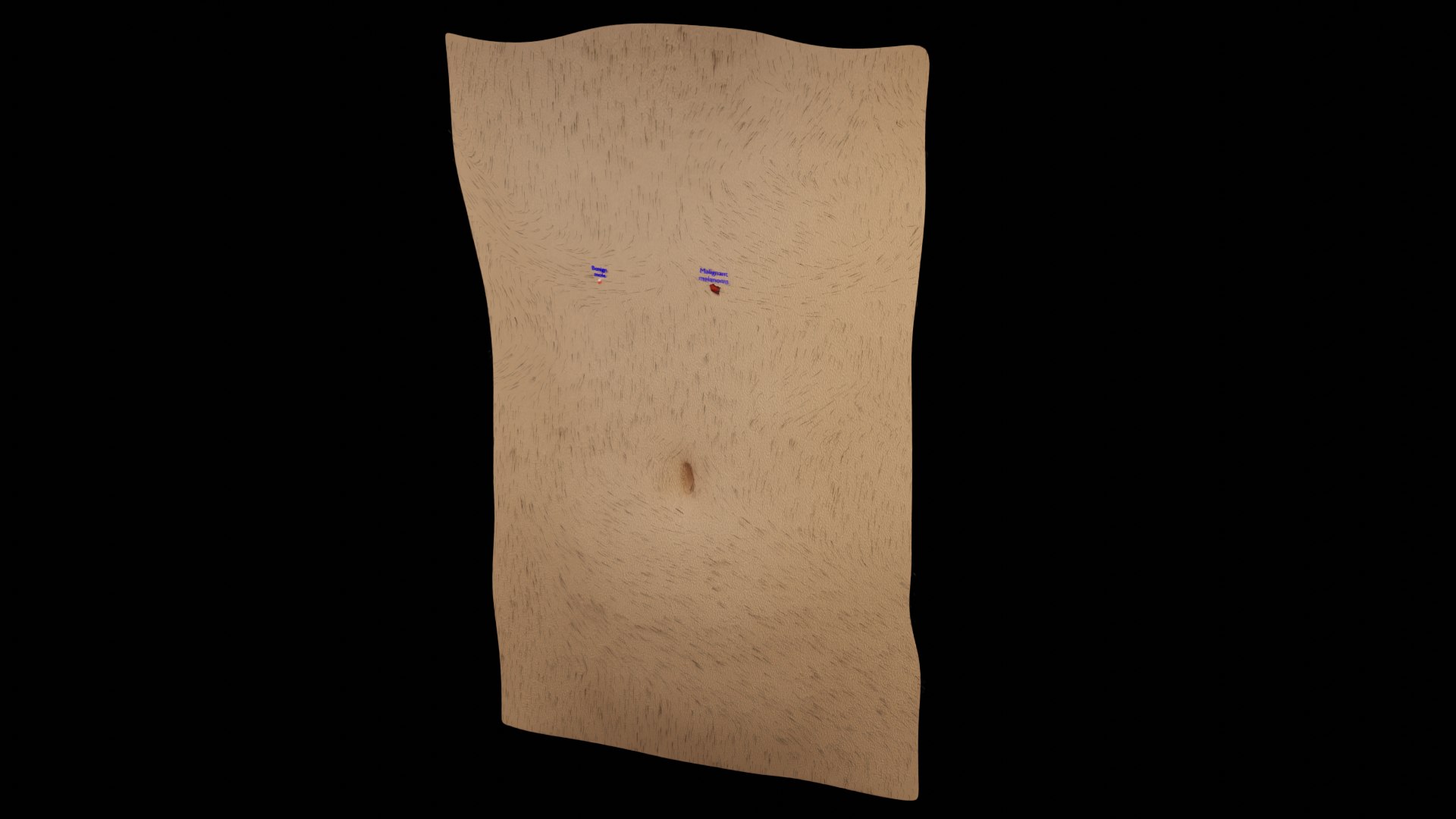 Mole nevus cancer Malignant melanoma differences 3D https://p.turbosquid.com/ts-thumb/c5/bKI6Vr/jg/ps2/png/1668228071/1920x1080/fit_q87/42253c779b518736ee8f36af537ae238ba842611/ps2.jpg