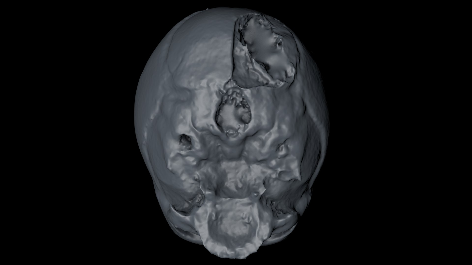 3d skull fetus model