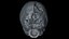 Fetus Skull Scan