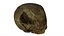 Fetus Skull Scan