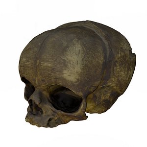 3d skull fetus model