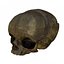 Fetus Skull Scan