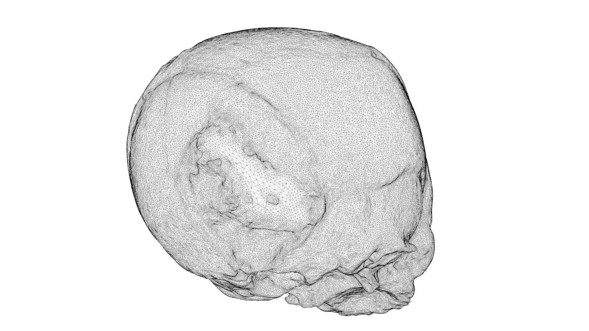 3d Skull Fetus Model