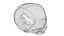 Fetus Skull Scan
