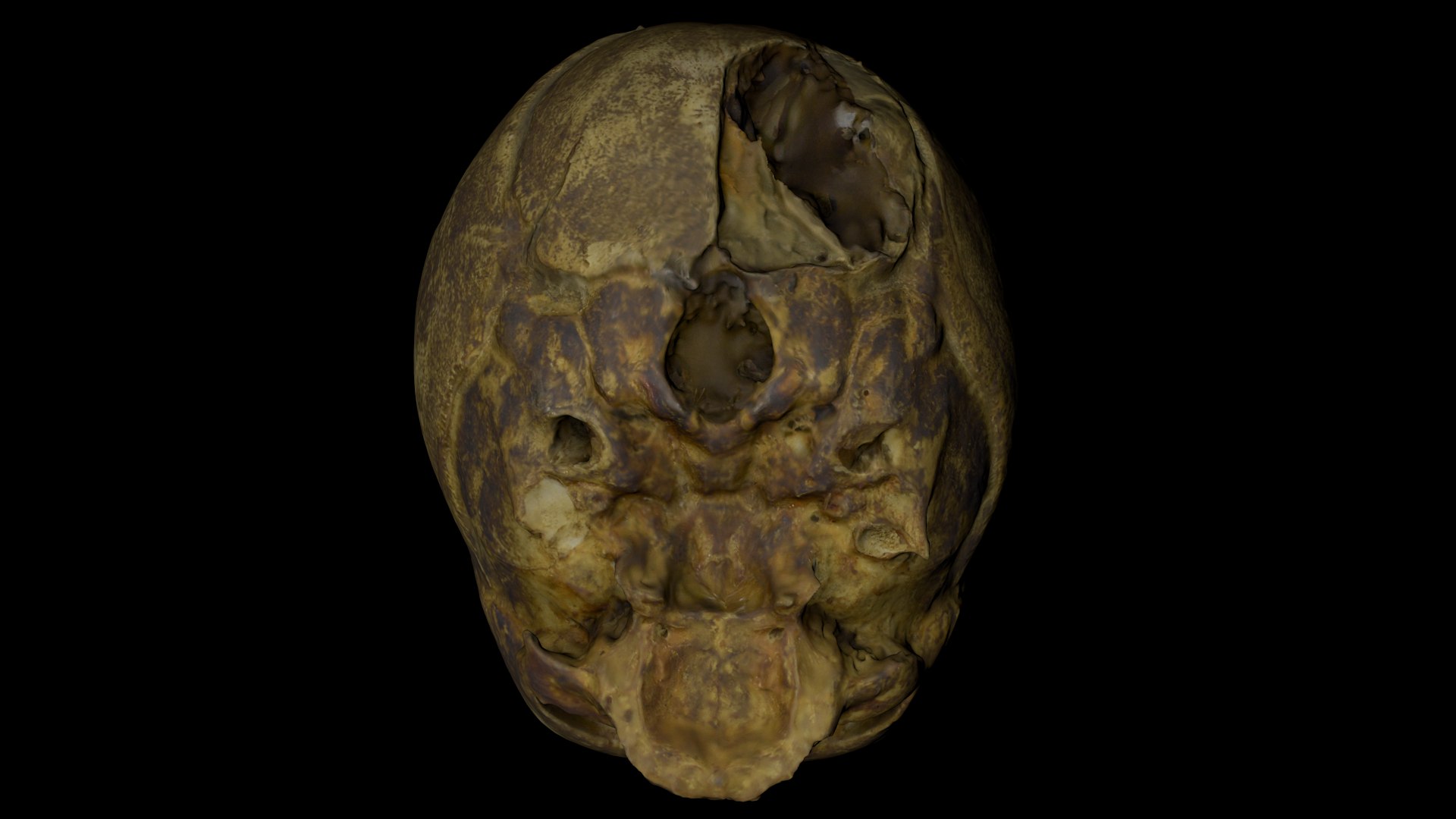 3d skull fetus model https://p.turbosquid.com/ts-thumb/c6/dEhT1T/B6/renderzzz0005/png/1649597859/1920x1080/fit_q87/1a395ef64100467e84875c9f86cf51710ffb8195/renderzzz0005.jpg