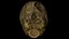 Fetus Skull Scan
