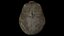Fetus Skull Scan