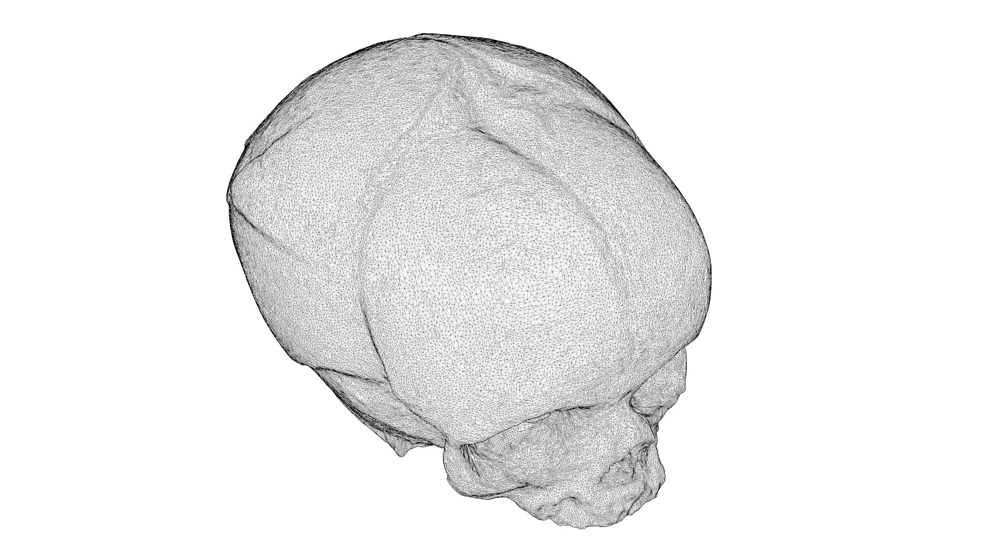 3d skull fetus model