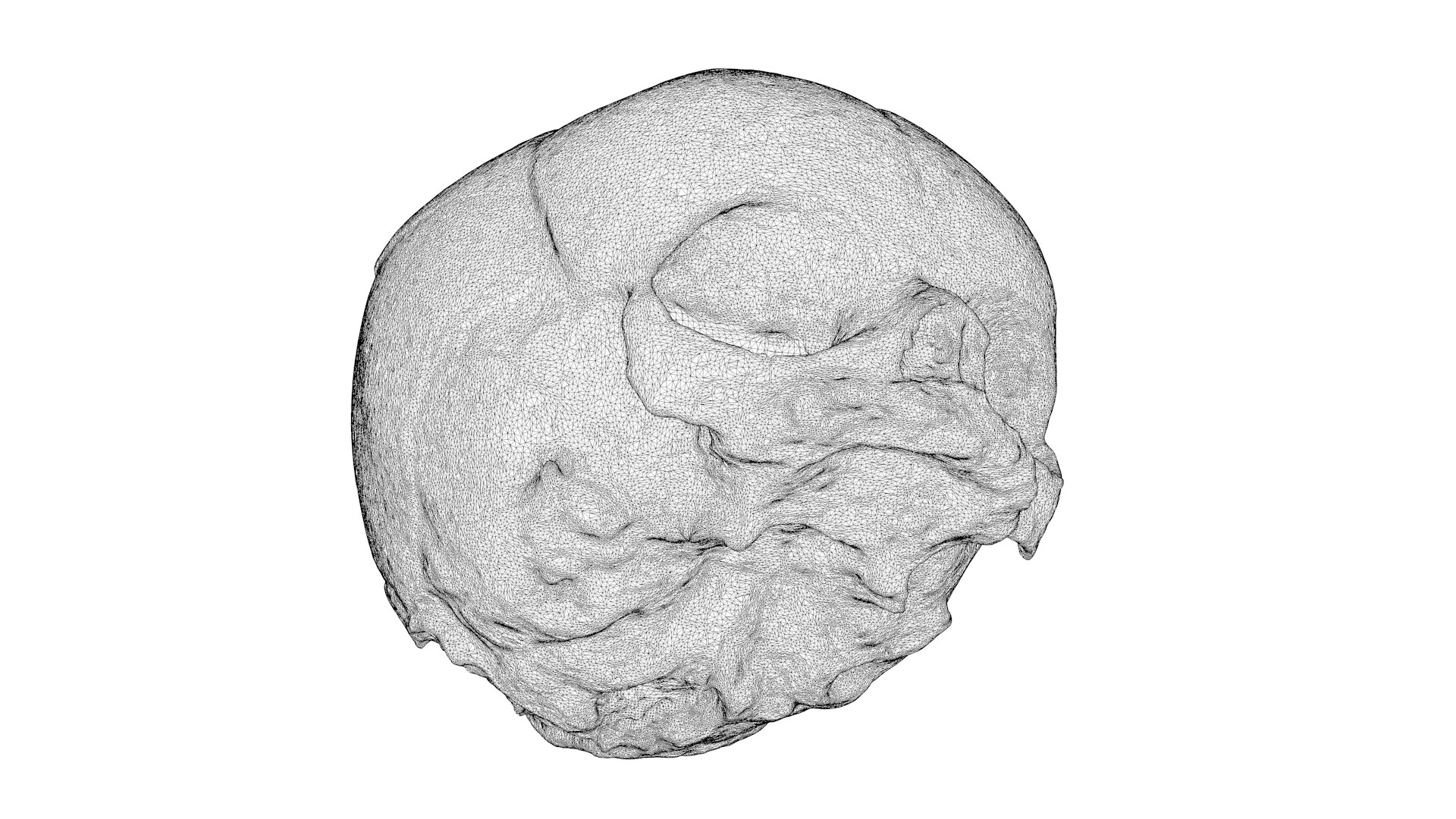 3d Skull Fetus Model