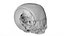 Fetus Skull Scan