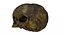 Fetus Skull Scan