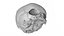 Fetus Skull Scan