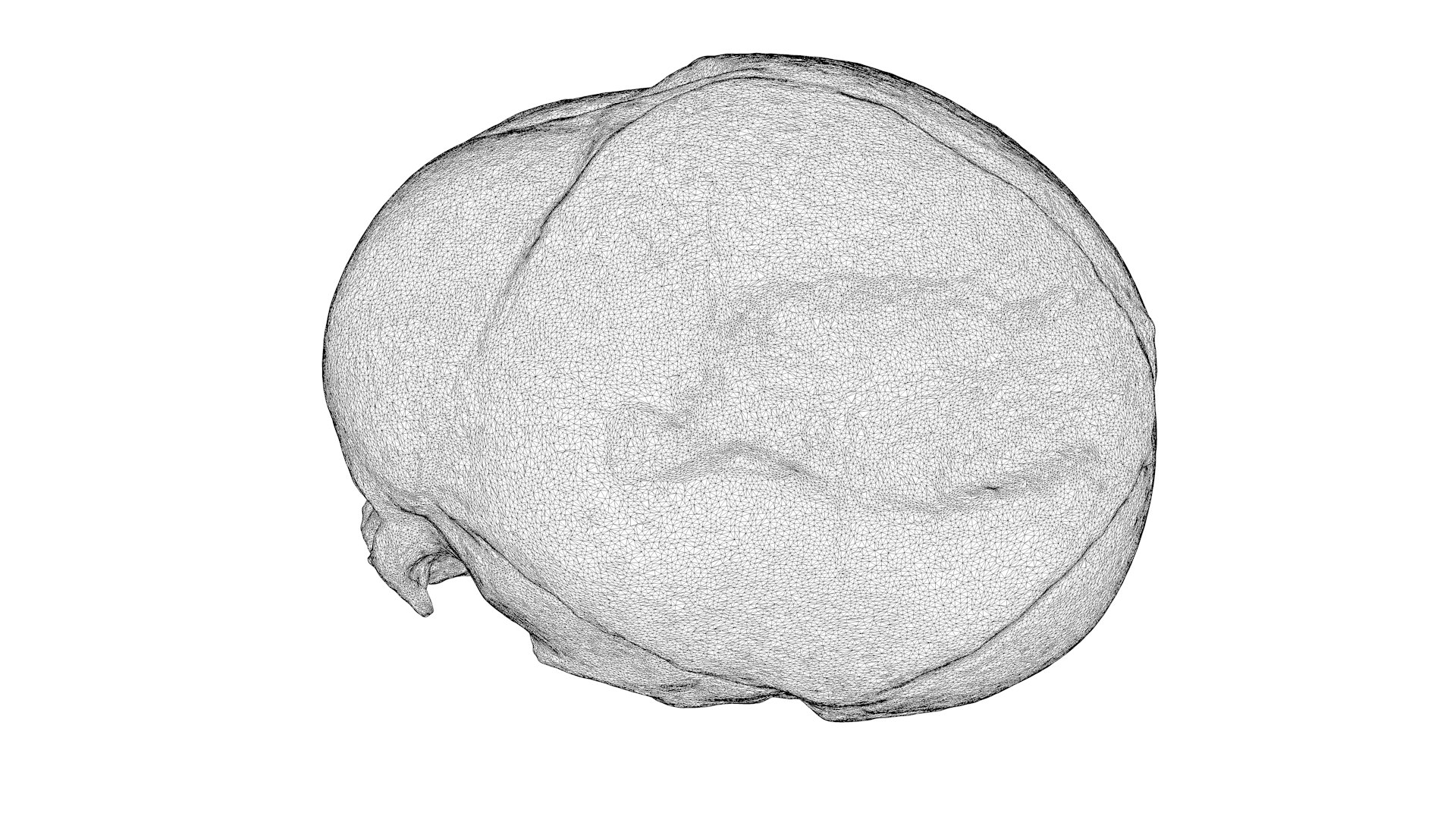 3d Skull Fetus Model