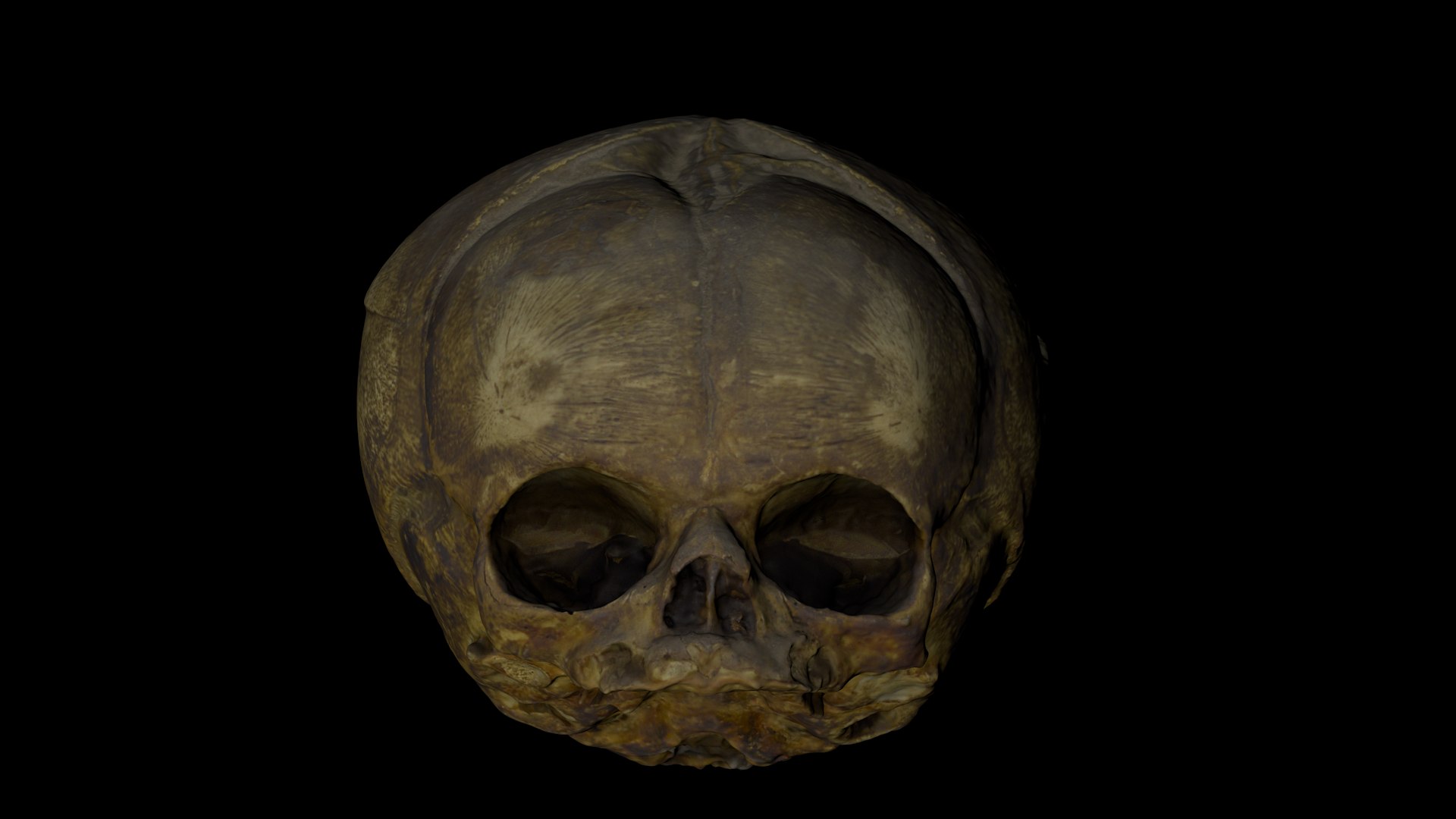 3d skull fetus model https://p.turbosquid.com/ts-thumb/c6/dEhT1T/YF/renderzzz0000/png/1649597785/1920x1080/fit_q87/6d98db30a4bcee88885cca49060782be659171af/renderzzz0000.jpg