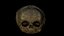 Fetus Skull Scan