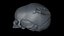 Fetus Skull Scan