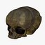 Fetus Skull Scan