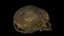 Fetus Skull Scan