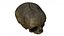 Fetus Skull Scan