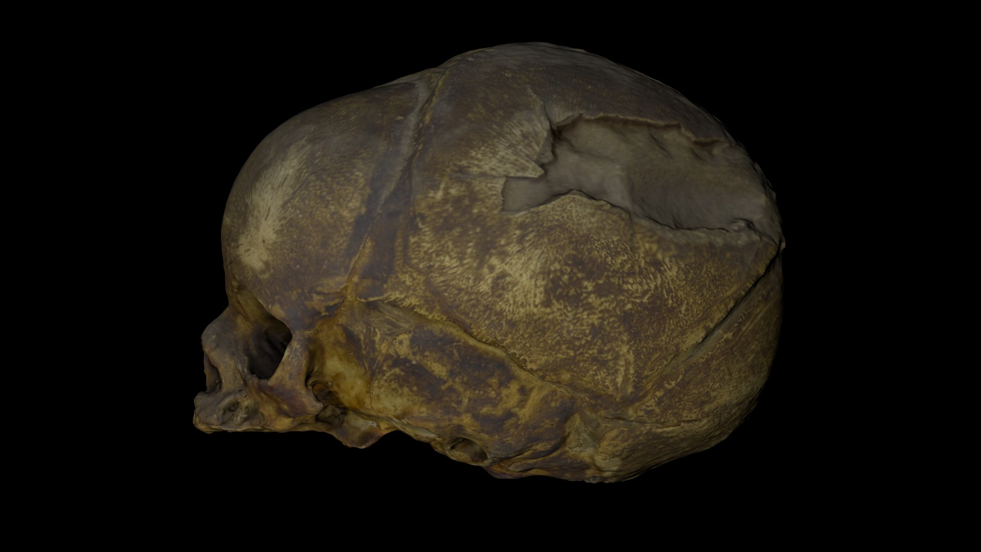 3d skull fetus model