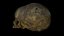 Fetus Skull Scan