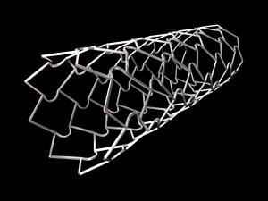 ScimedStent2.max