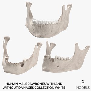 Human Male Jawbones With And Without Damages Collection White - 3 models 3D model