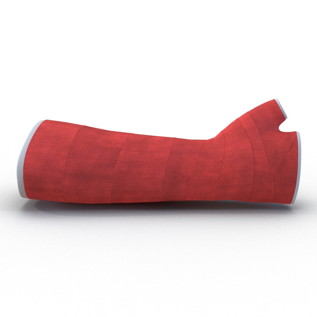 orthopedic cast arm 3d 3ds