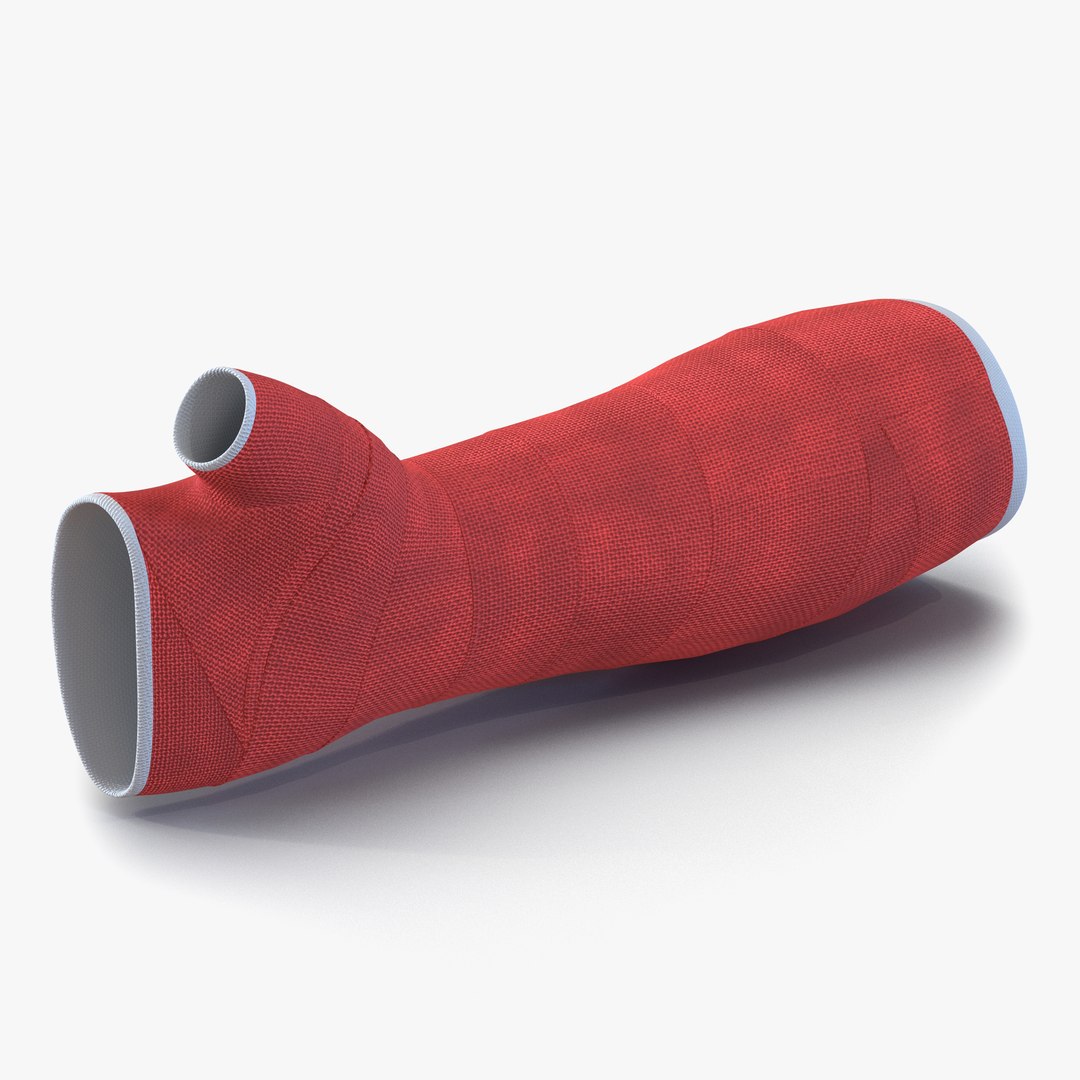 Orthopedic Cast Arm 3D model preview