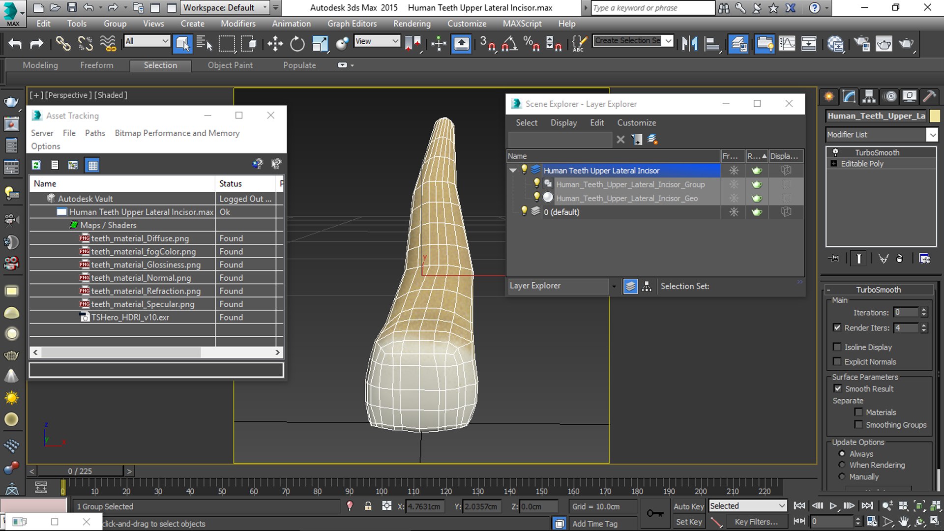 upper human teeths dentition 3D model https://p.turbosquid.com/ts-thumb/cS/8oQgBf/rHG2gANo/viewport/jpg/1586805421/1920x1080/fit_q87/f6999b759f9416a84d37b13a7dc11eb5b5336abc/viewport.jpg