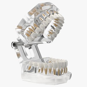 Transparent Dental Typodont With Dental Implants