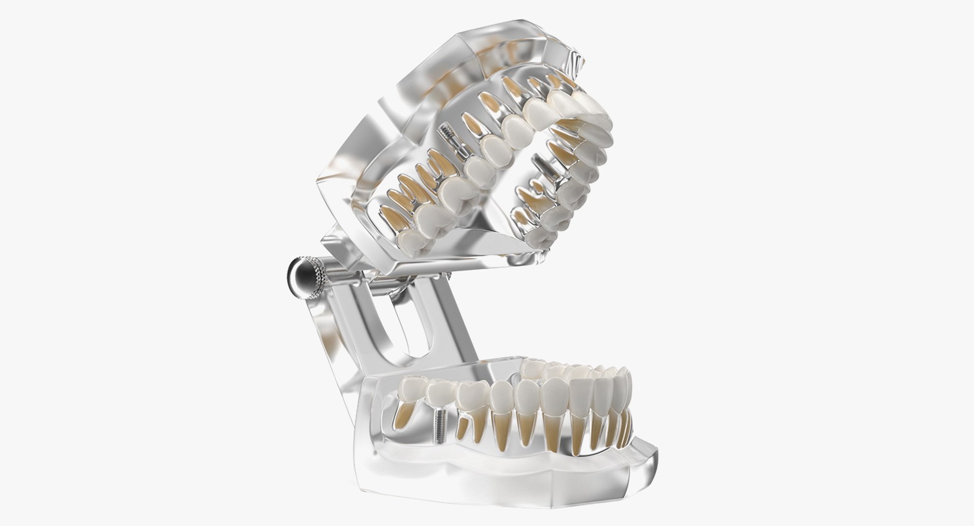 Transparent Dental Typodont With Dental Implants 3D model preview