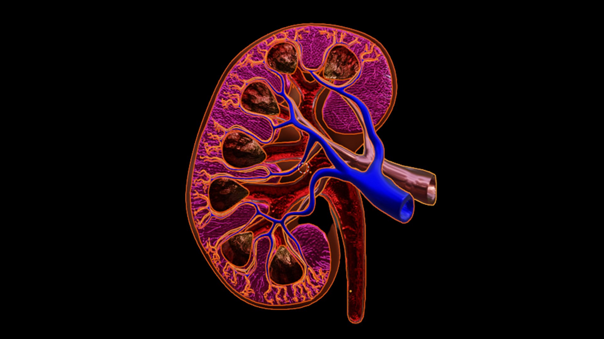 3D 3D Model of Human Kidney cross section model - TurboSquid 2077213