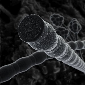 3d model bronchial tube