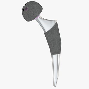 Femoral Prosthesis