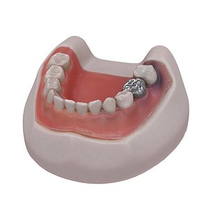 Teeth - Harvard Dental Typodont Model Scan