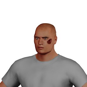 Injured Man