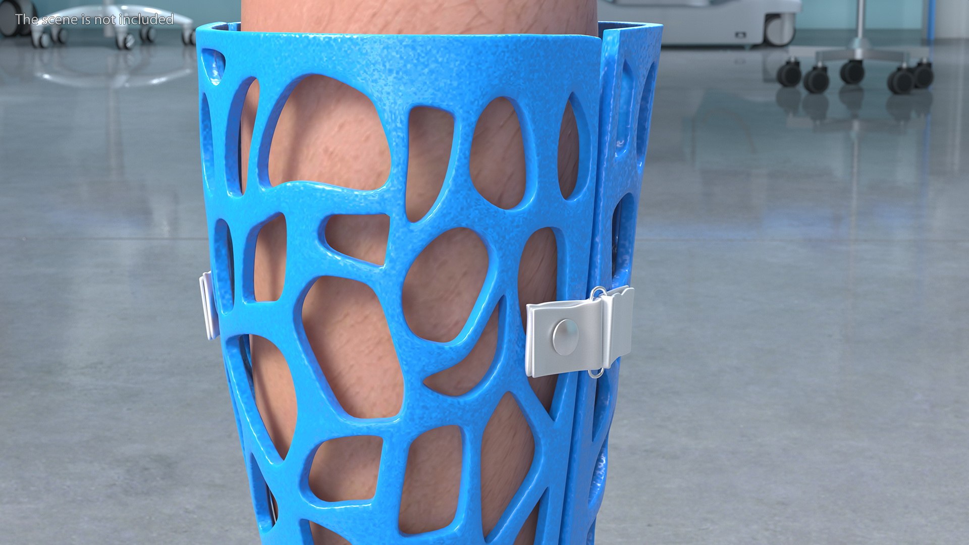 3D-Printed Orthopedic Cast On Leg Model - TurboSquid 1900350