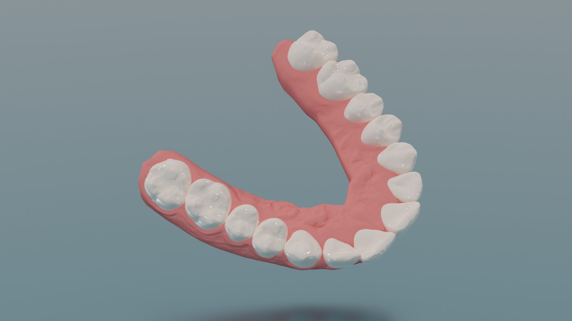 3D Dental Upper Jaw 3D Scanned Mouth With Separated Teeth 3D Print ...