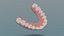 Dental upper jaw 3D scanned mouth with separated teeth 3D print model