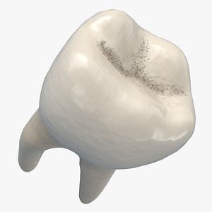 Molar Tooth