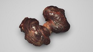 Thyroid Gland