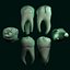 Maxillary first molar
