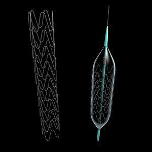Stent and Balloon