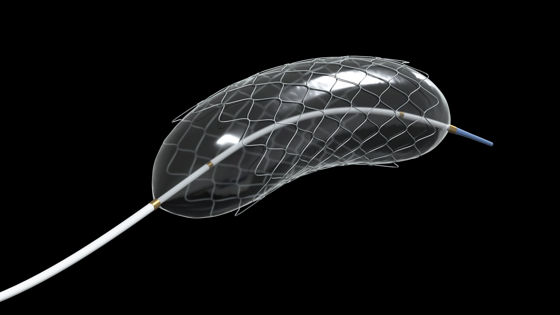 3d Medical Balloon-expandable Stent - Turbosquid 1701176