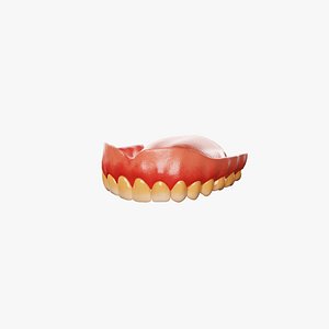Dental Prosthesis