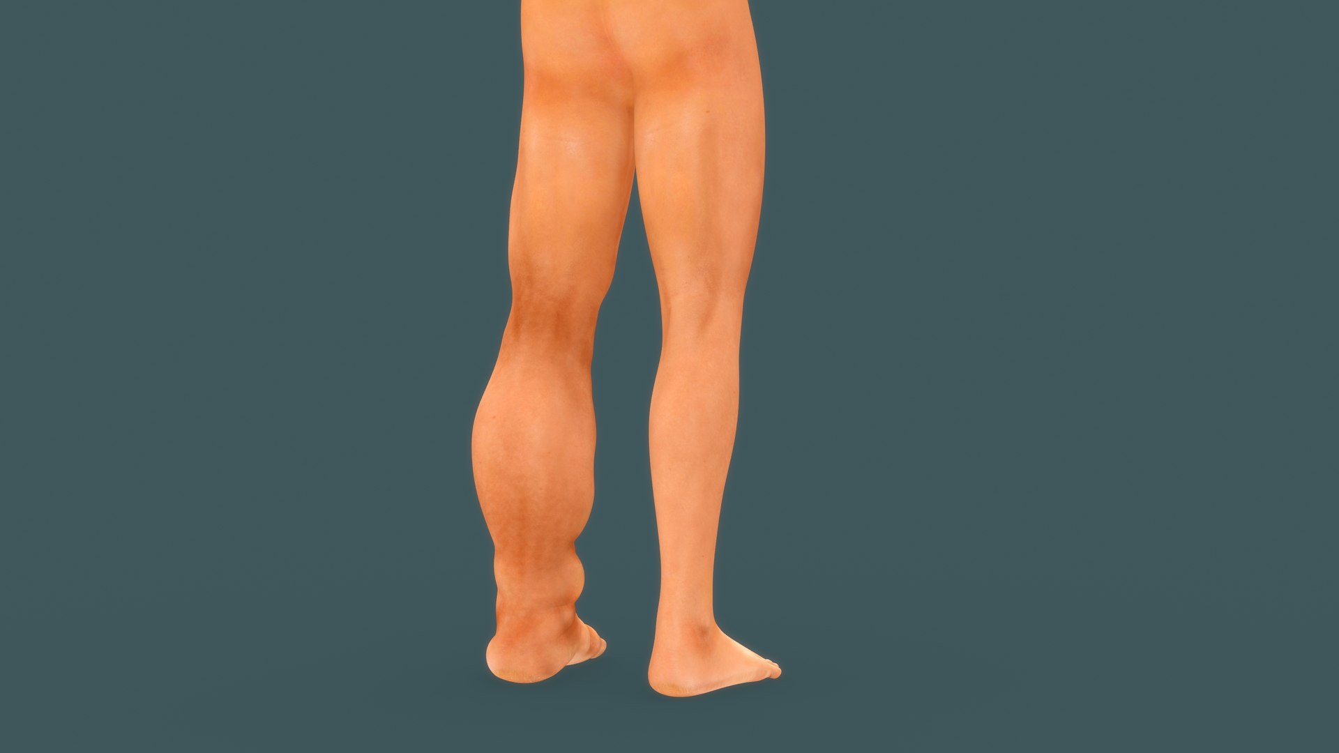 Lymphatic filariasis model https://p.turbosquid.com/ts-thumb/dn/EPqSk1/1G/b0723filariasis_back/jpg/1632467682/1920x1080/fit_q87/1de93ba239e67babbd2c11c56273e00df80746bf/b0723filariasis_back.jpg
